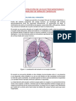 Electrocardiogram A