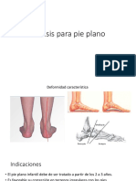 Ortesis para Pie Plano