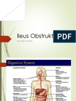 Ileus Obstruktif 