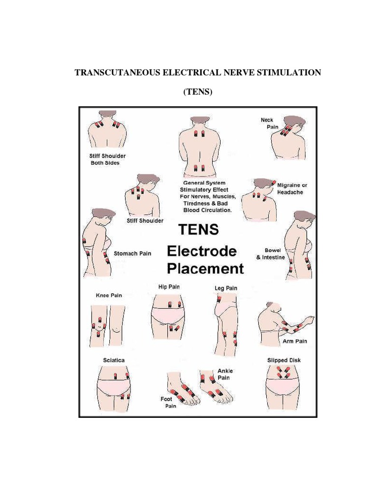 Transcutaneous Electrical Nerve Stimulation | PDF