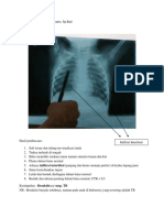 Tentir 1 - Dr. Freddy, SP - Rad