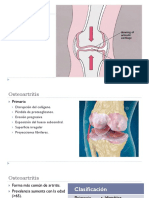 Artritis no inflamatoria.pptx