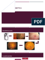 Retinopatia Diabetica