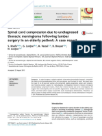 Spinal Cord Compression Due To Undiagnosed Thoracic Meningioma Following Lumbar Surgery in An Elderly Patient: A Case