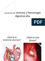 Síndrome Ulceroso y Hemorragia Digestiva Alta