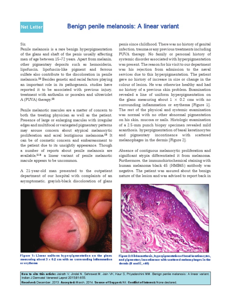 Melanosis | PDF | Cutaneous Conditions