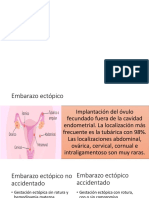 EMBARAZO ECTOPICO.pptx