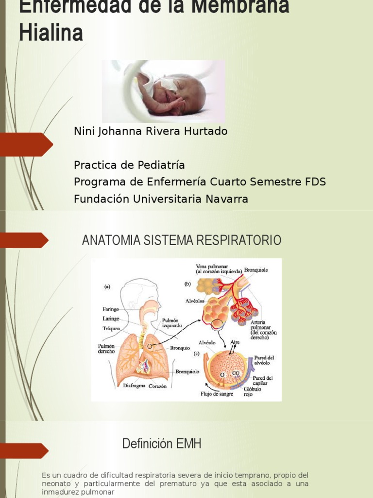 Enfermedad de La Membrana Hialina PDF