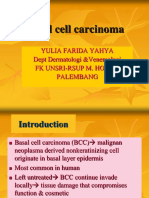 Basal Cell Carcinoma: Yulia Farida Yahya Dept Dermatologi &venereologi FK Unsri-Rsup M. Hoesin Palembang