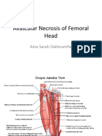 Avascular Necrosis of Femoral Head