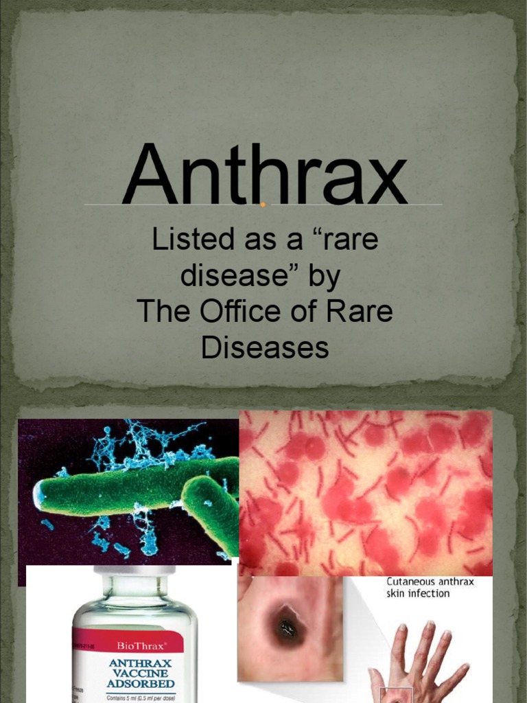 Understanding Anthrax in Humans | PDF | Science & Mathematics