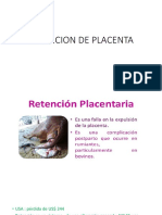 Retencion de Placenta