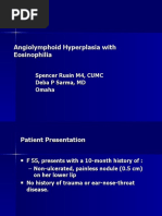 Download Angiolymphoid Hyperplasia With Eosinophilia  F 55 Lower Lip by Deba P Sarma SN36535862 doc pdf