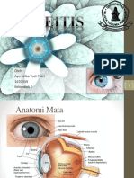 Uveitis 