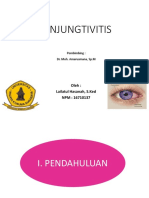 KONJUNGTIVITIS