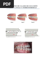 Clasificacion de Lisher | PDF