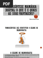 Tomossíntese Mamária Digital