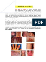 Cara Menyembuhkan Luka Lecet Di Kelamin