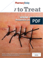 Treating Wound Infections