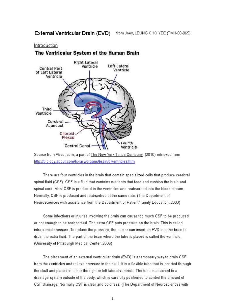 External Ventricular Drain | PDF | Cerebrospinal Fluid | Clinical Medicine
