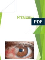 Penyuluhan Pterigium