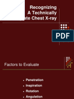 Recognizing A Technically Adequate Chest X-Ray