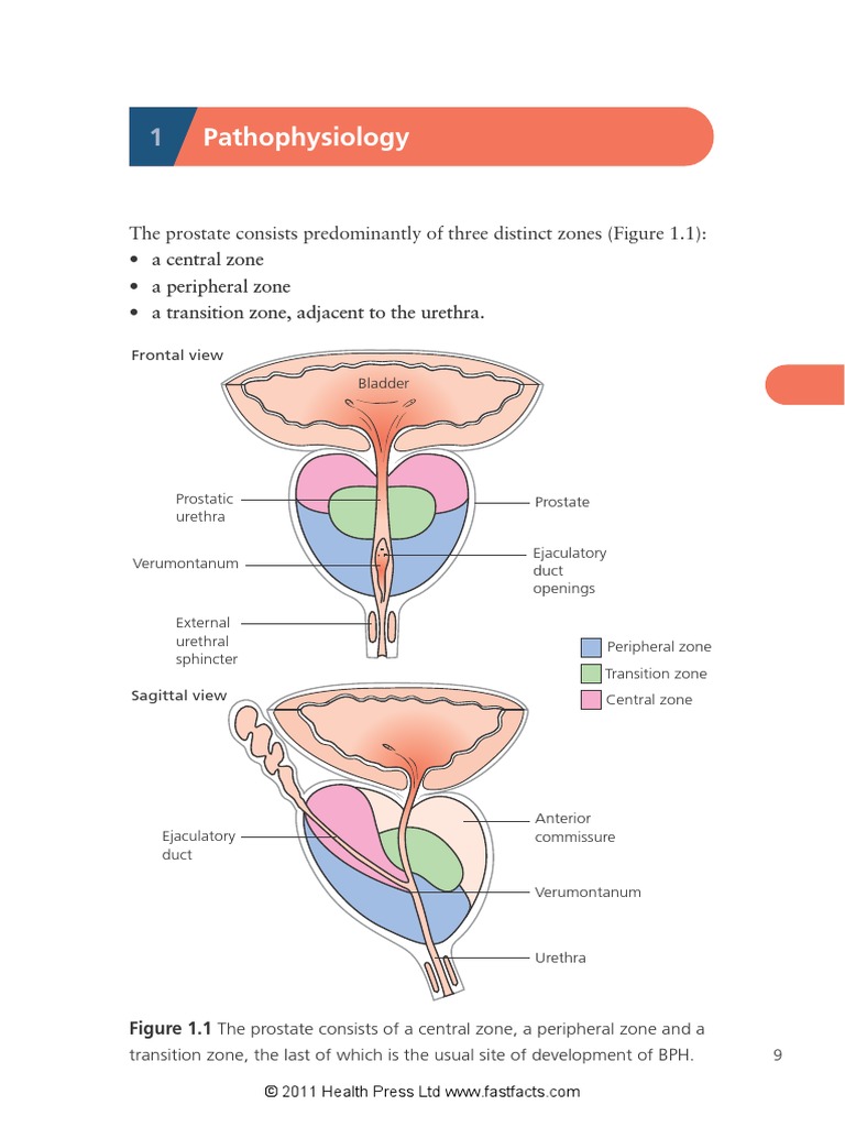 BPH 2 | PDF | Prostate Specific Antigen | Prostate