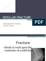 Patellar Fracture: Karla Suzatte M. Dasargo DDC PT - Intern