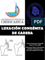 Luxacion Congenita de Cadera