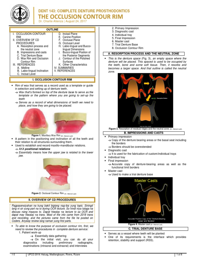 FINAL 1 5 The Occlusion Contour Rim Dent 143 Dentures Anatomical Terms Of Location