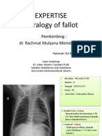 Expertise Tetralogy of Fallot