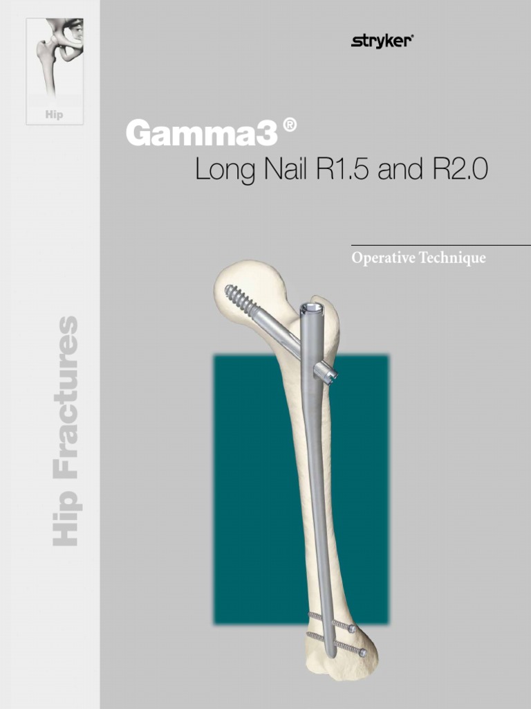 Gamma3 Long Nail r15 and r20 Operative Technique Screw Anatomical