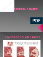 Colon Cancer