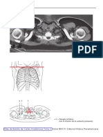 Figure 7 from Desentrañando la tecnología de la tomografía computarizada  helicoidal multicorte (TCMC)