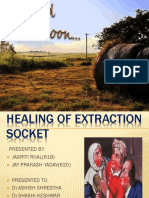 Healing of Tooth Extraction Sockets