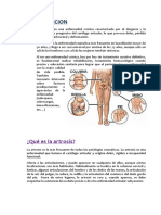 Artrosis l.l