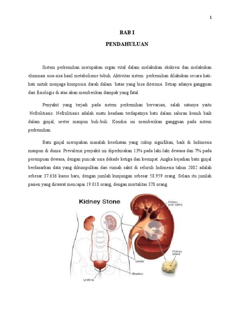 Nefrolitiasis adalah