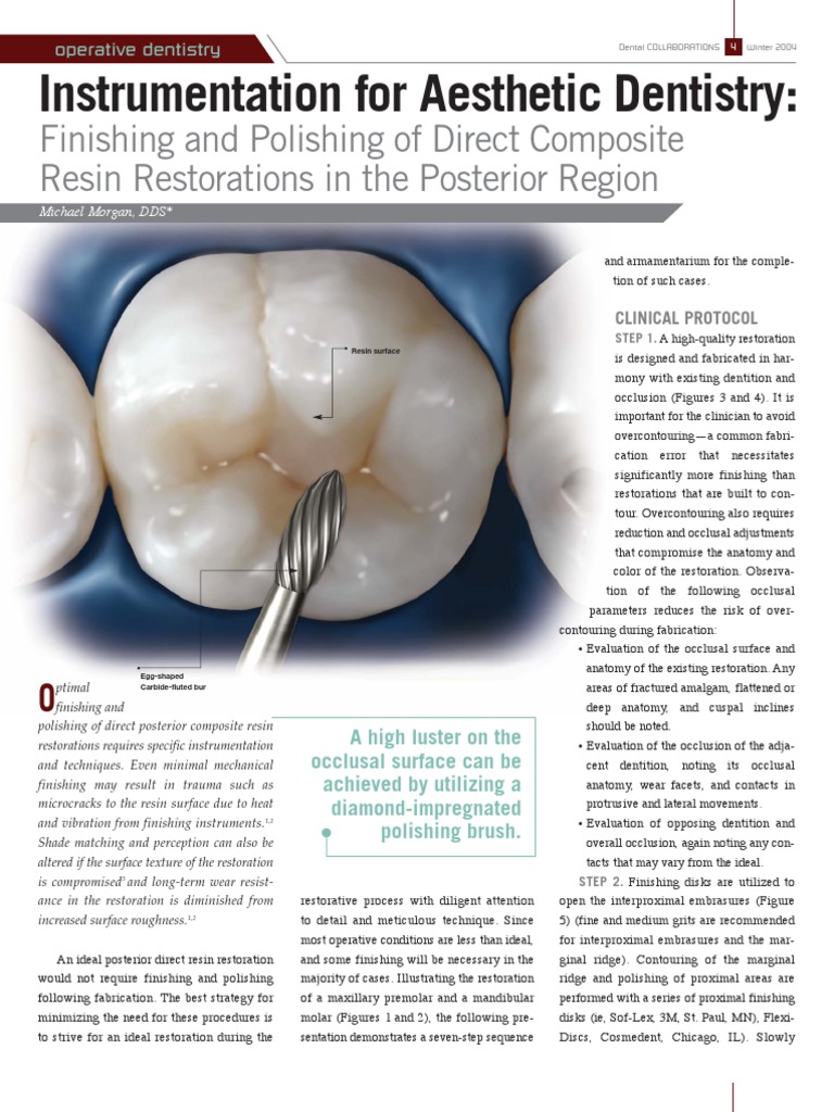 Finishing Techniques for Posterior Composites | PDF | Dental Composite ...