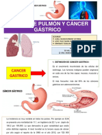 Cancer de Pulmon y Gastricoo Terminado