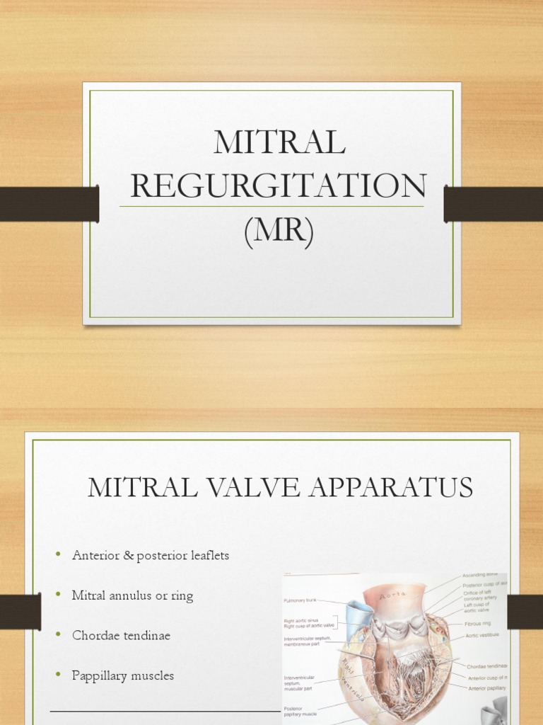 Mitral Regurgitation Overview and Management | PDF | Heart Valve ...