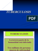 tuberculosis.ppt
