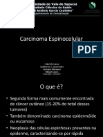 Carcinoma Espinocelular: Sinais, Fatores de Risco e Tratamento