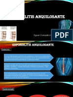 espondilitisanquilosante-170423151436