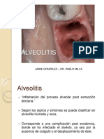 Alveolitis 130527180045 Phpapp02