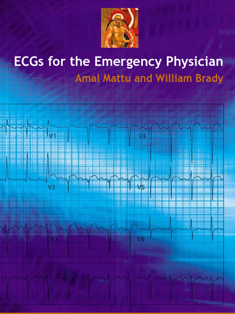 Ecg for Emergency Physician
