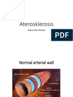 aterosklerosis-170517061317