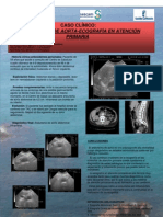 Aneurisma de Aorta-Ecografía en Atención Primaria