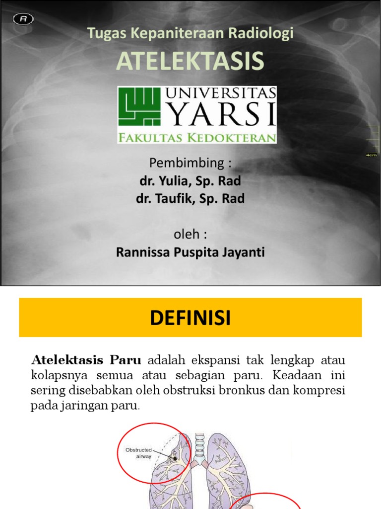 Atelektasis | PDF