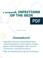 Fungal Infections of The Skin: by Bekele T. (BSC, MSC) 1