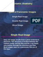 Panoramic Anatomy: Types of Panoramic Images
